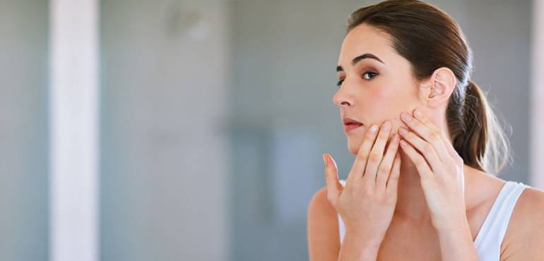 acne and acne scars management