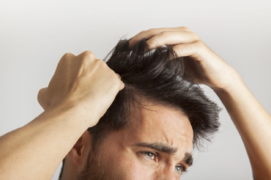 best hair loss treatment doctor in delhi