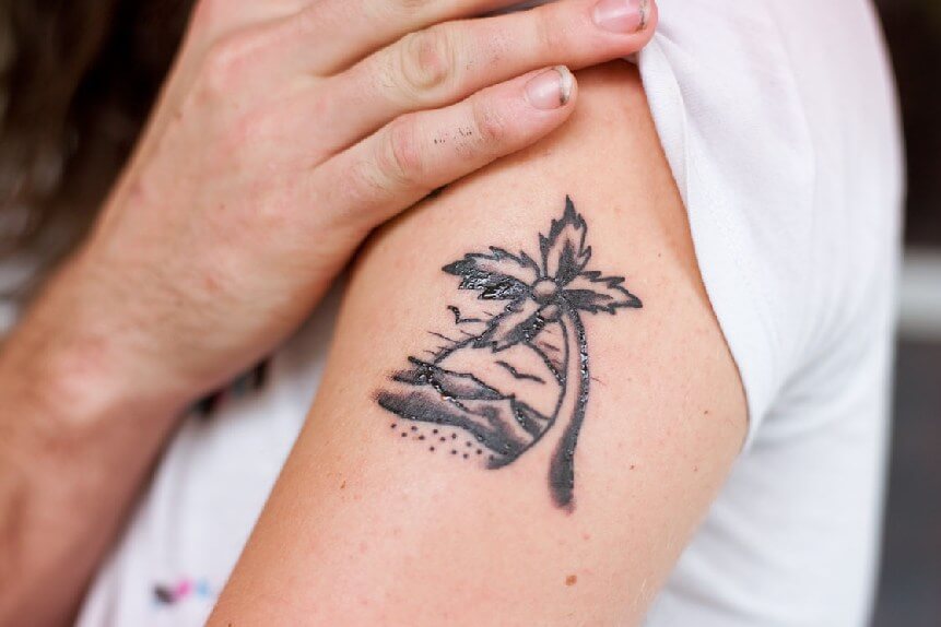 Laser Tattoo Removal in Delhi