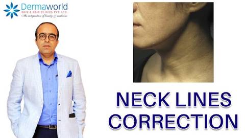 Get Rid of Necklines Correction & Wrinkles | Dr. Rohit Batra