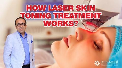 Laser Toning