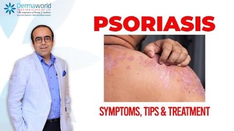 Psoriasis