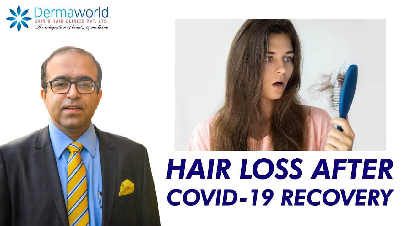 Hair Loss After Covid 19 Recovery