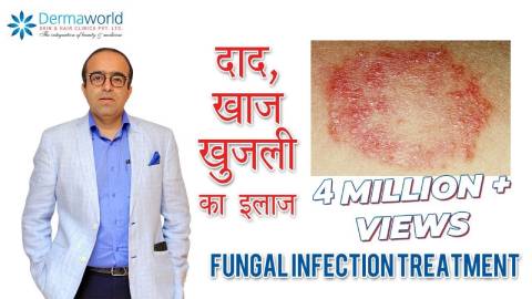 Best Fungal Infection Specialist in Delhi