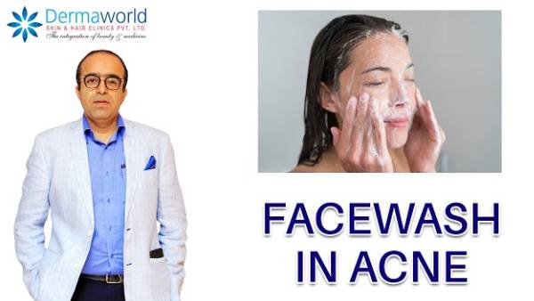 Facewash in Acne | Dr. Rohit Batra